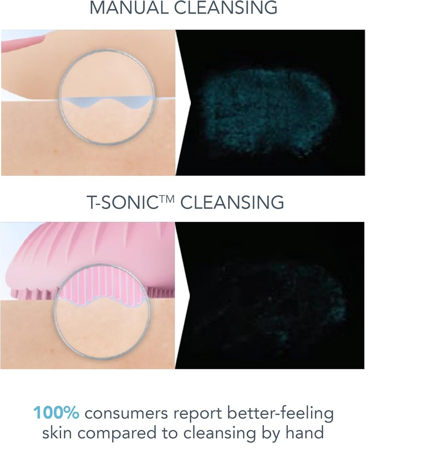 Foreo Luna 3 Facial Cleansing Brush